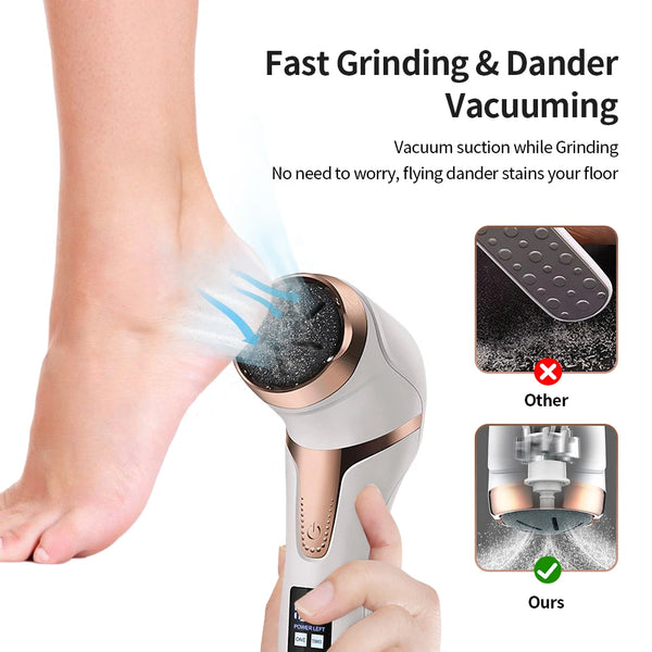 Foot Skin Callus Remover Machine